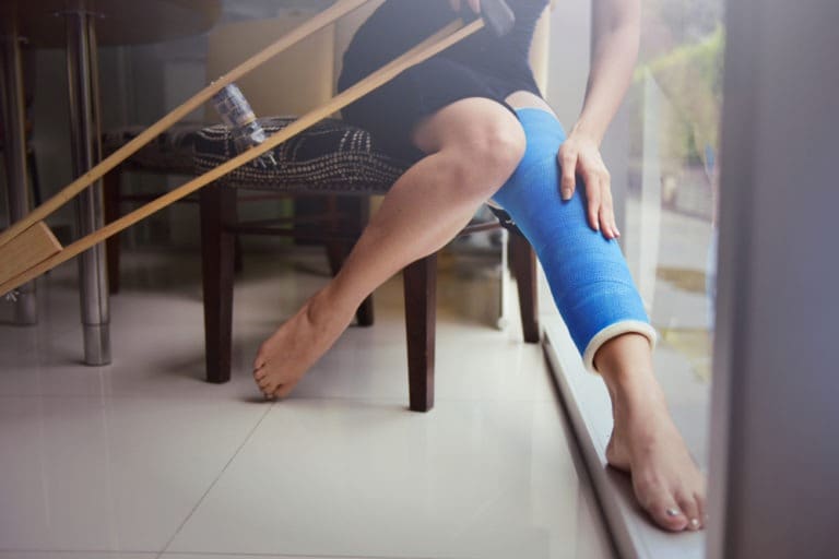woman with a leg cast