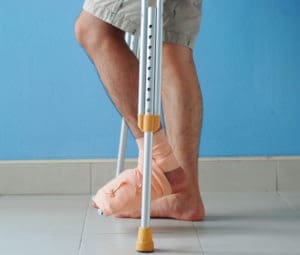 person with a leg splint