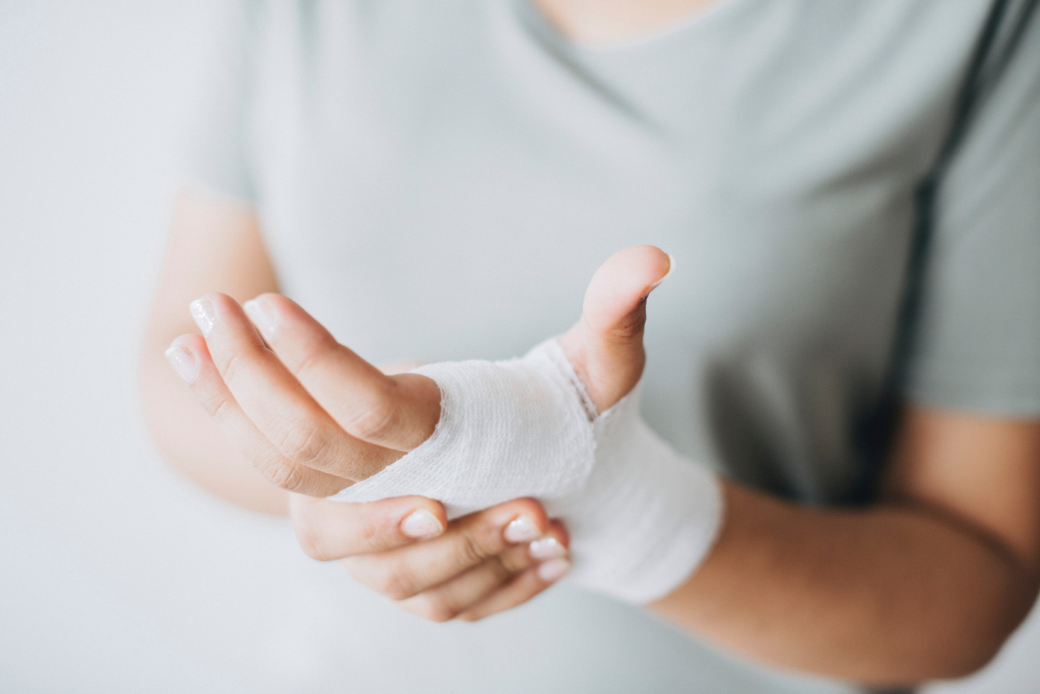Injury hand foto