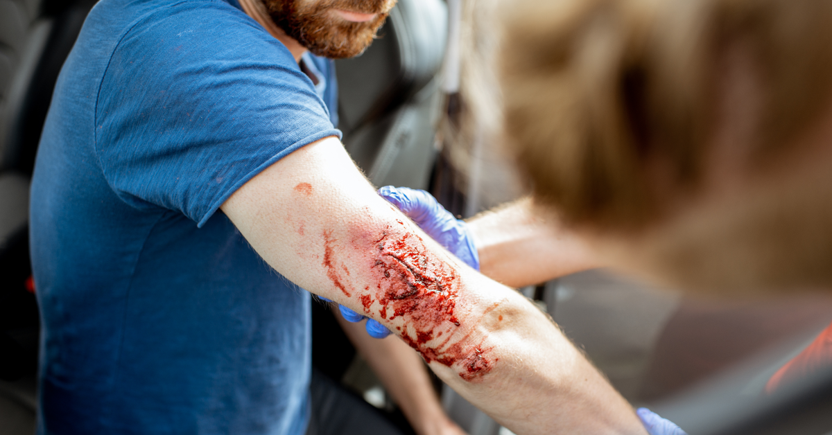 Las Vegas Car Accident Injuries