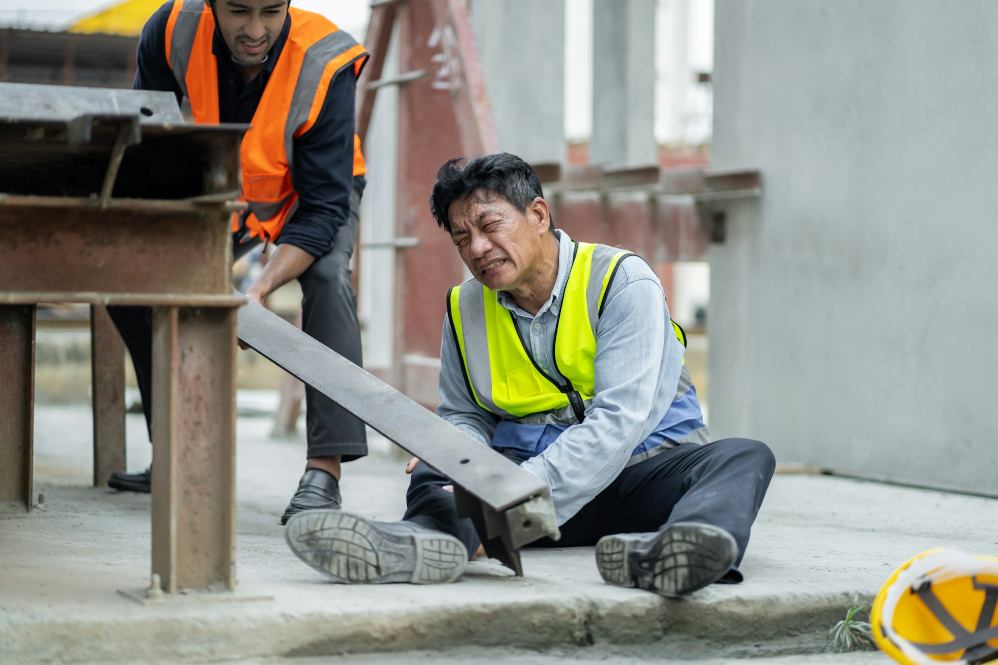 An engineer has an accident where steel falls on his leg at work