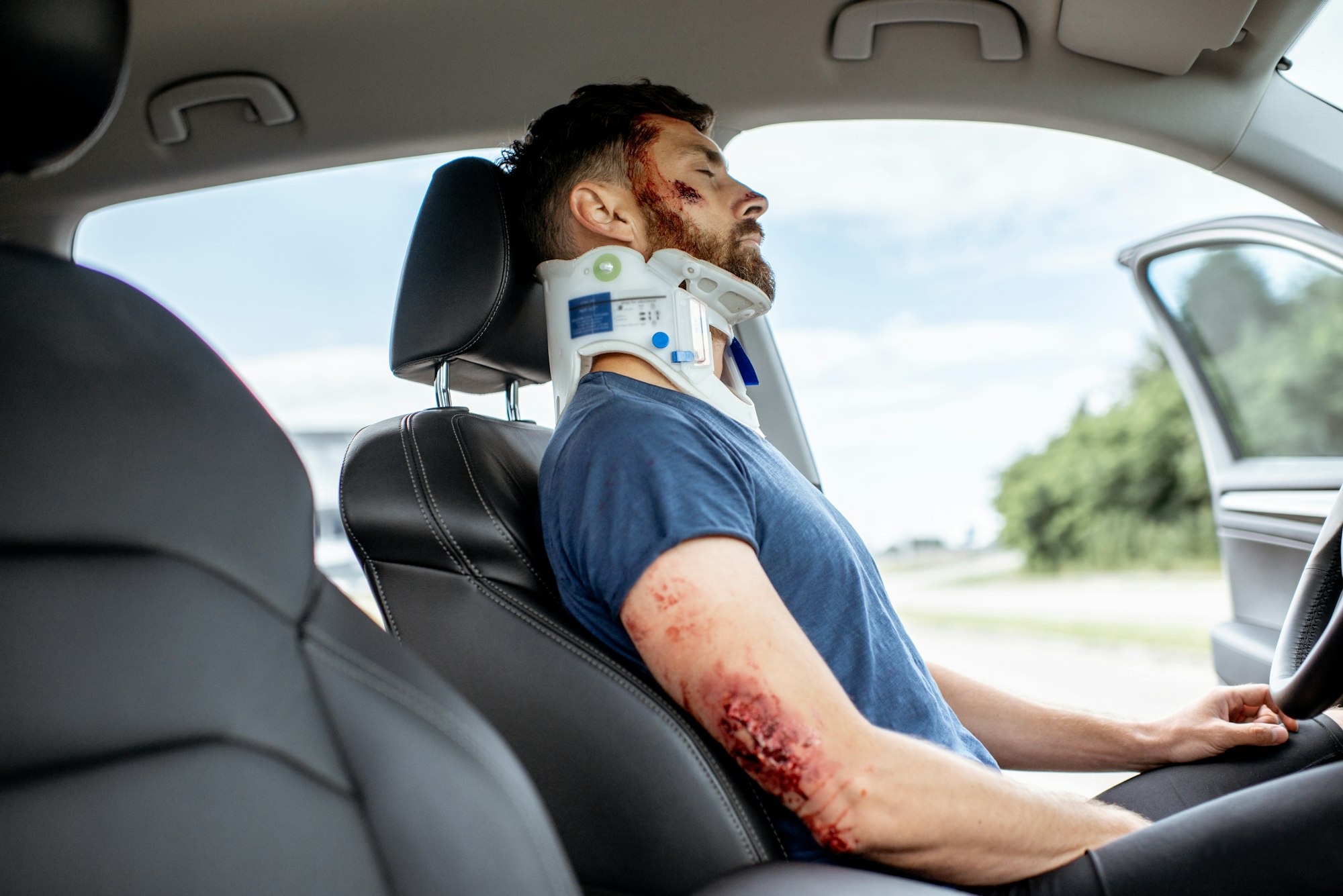 Injured man on the driver seat after the accident