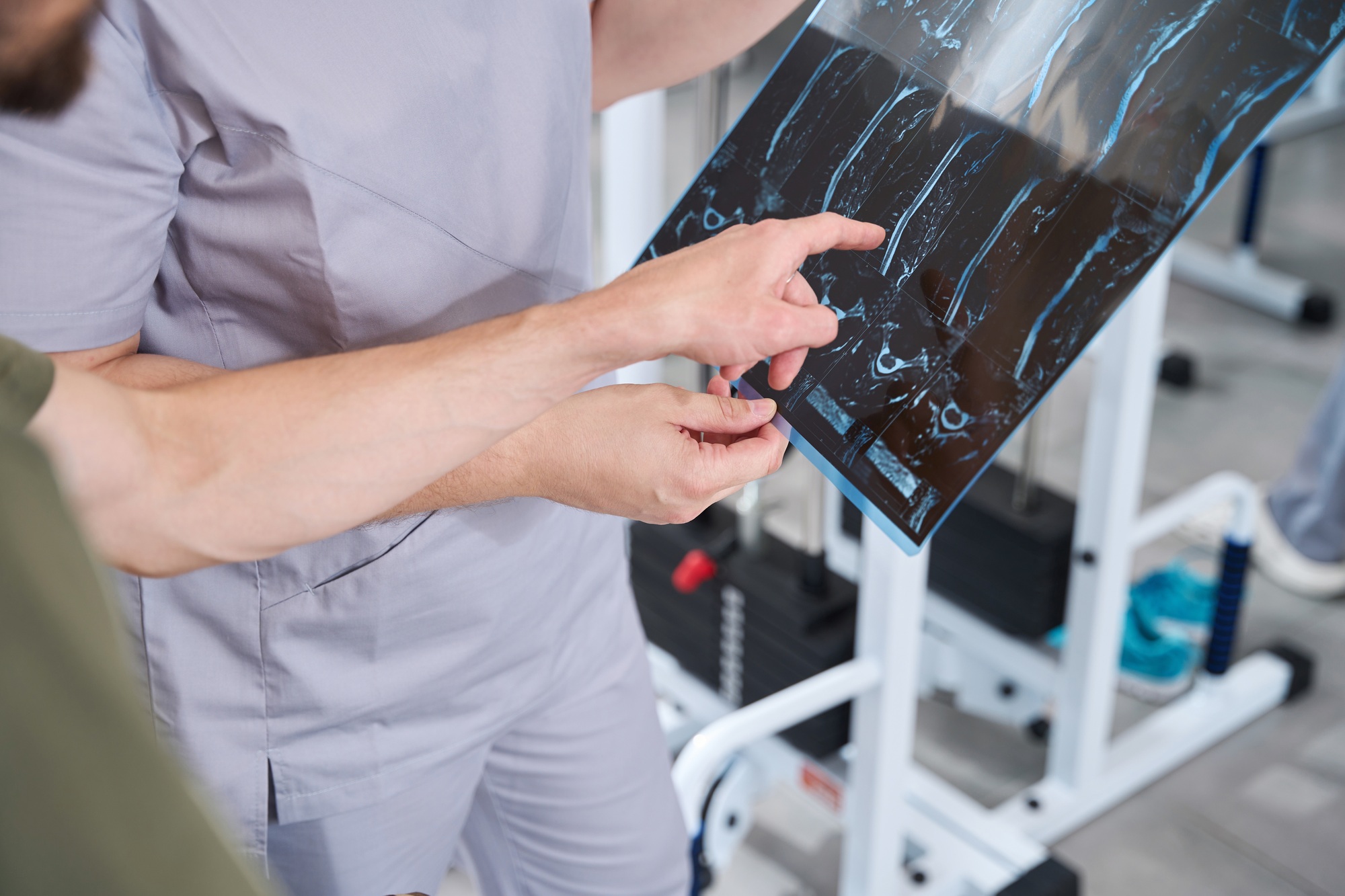 Doctor with patient examining x-rays of injuries